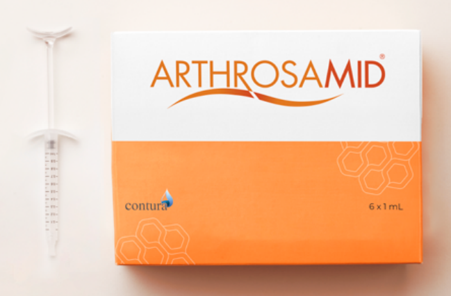 Advanced Knee Pain Treatment Without Surgery: Introducing Arthrosamid&reg;