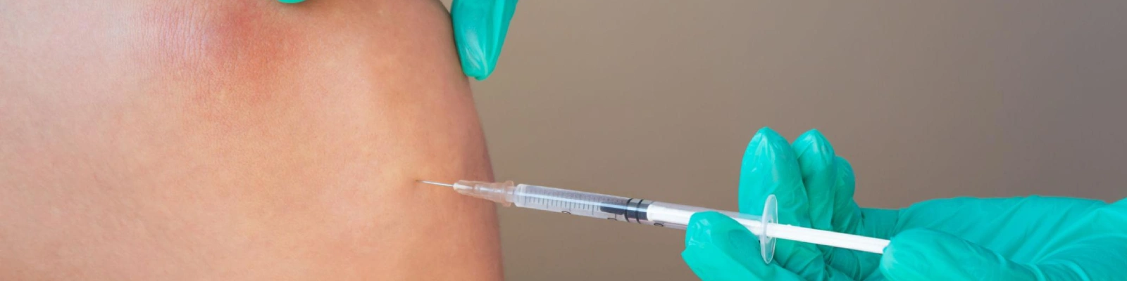 Durolane Injection Therapy