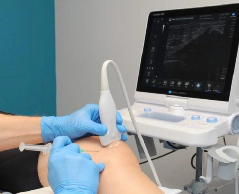 Ultrasound-guided Injection Therapy
