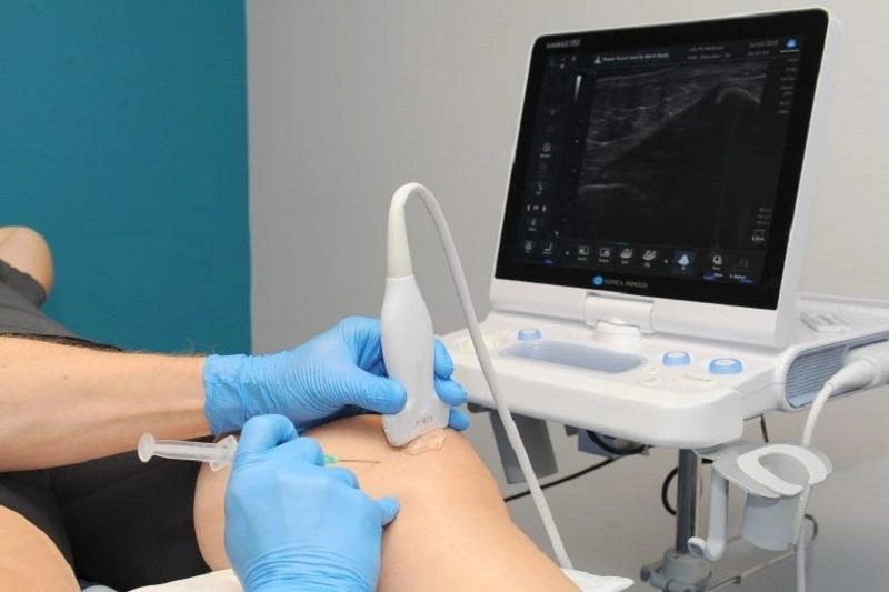 Ultrasound Guided Injections