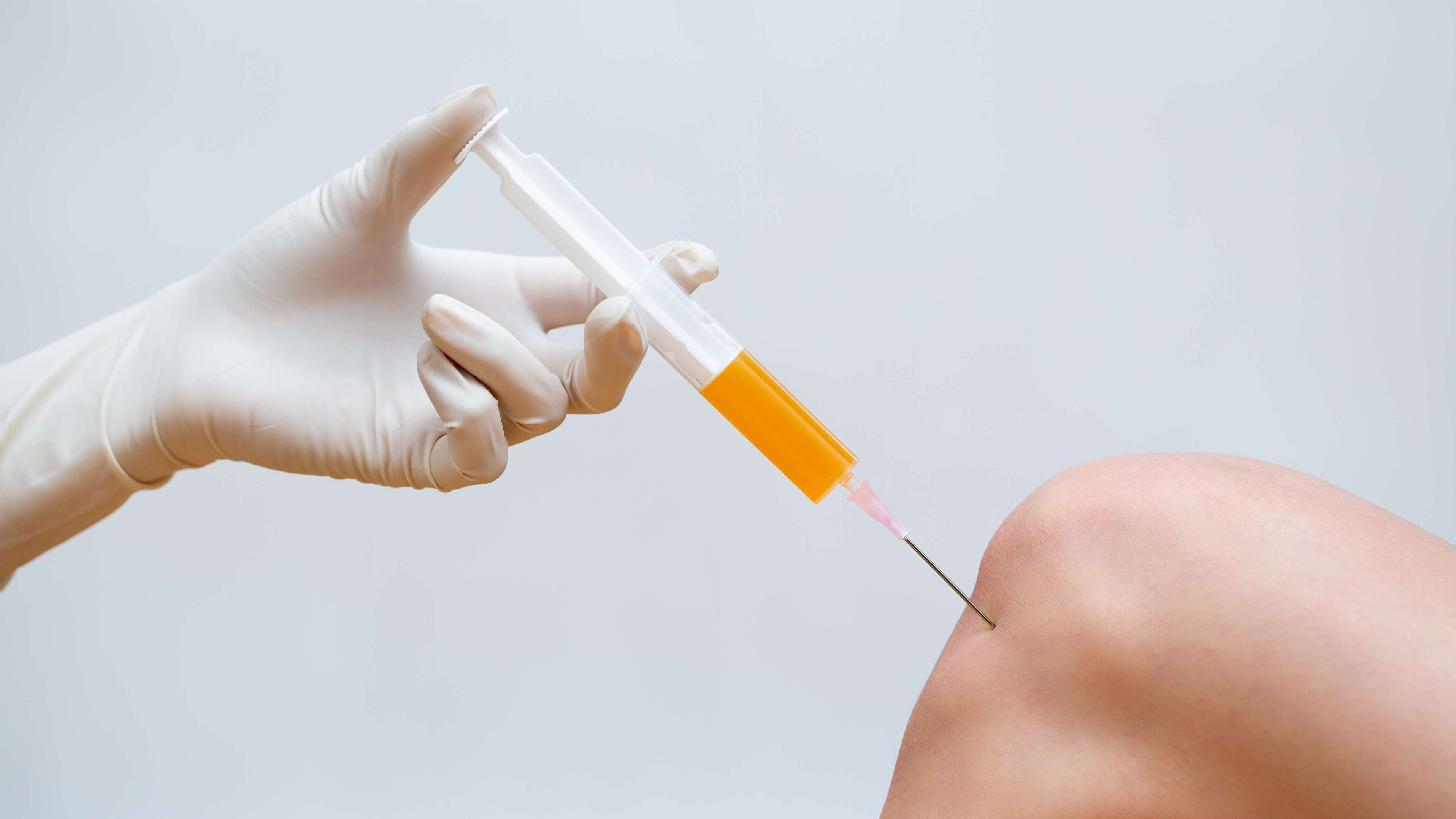 Steroid Injection Therapy